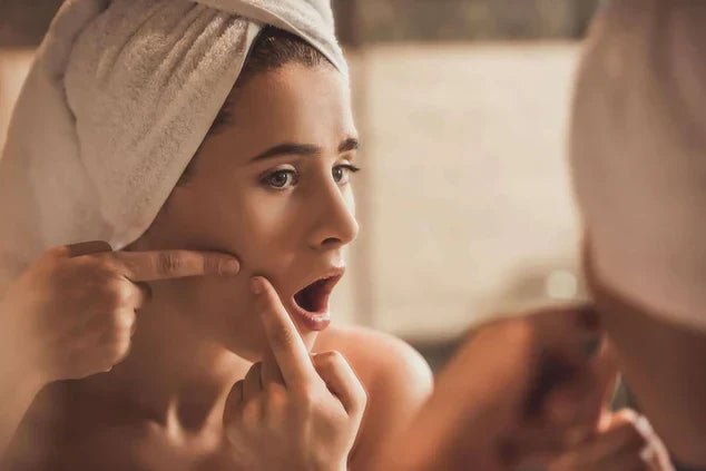 Skin Care Routine for Acne Prone Skin