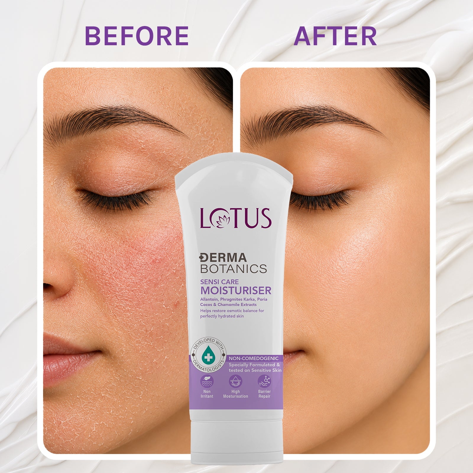 Lotus Derma Botanics Sensi Care Moisturiser