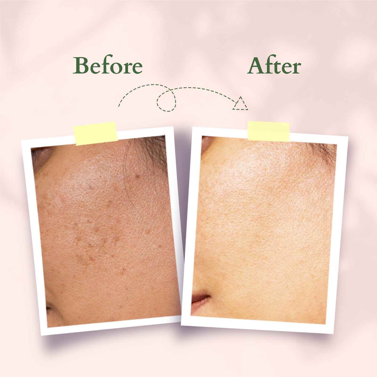 Lotus Organics+ Precious Brightening Facial Oil