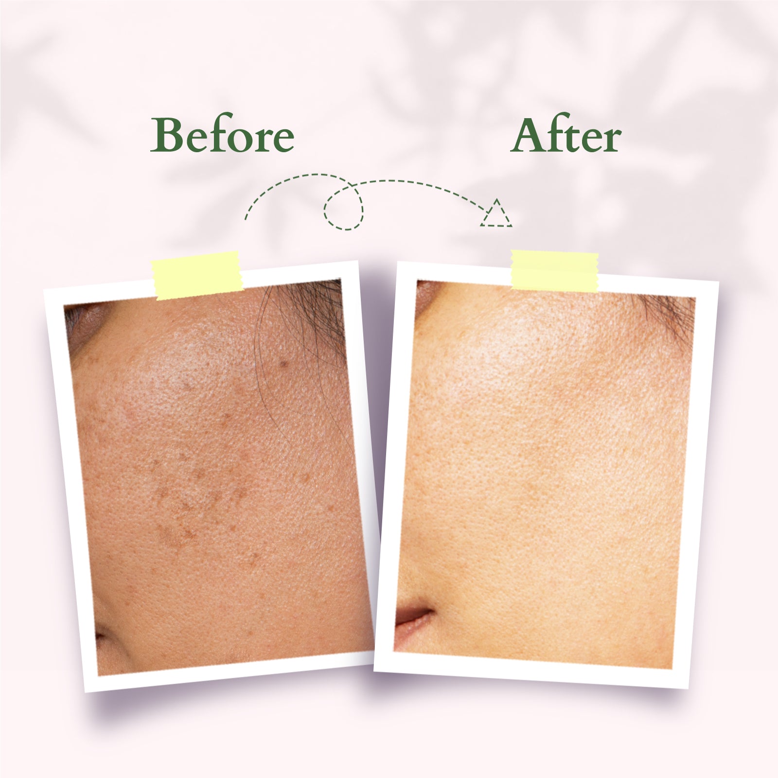Lotus Precious Brightening Face Exfoliator
