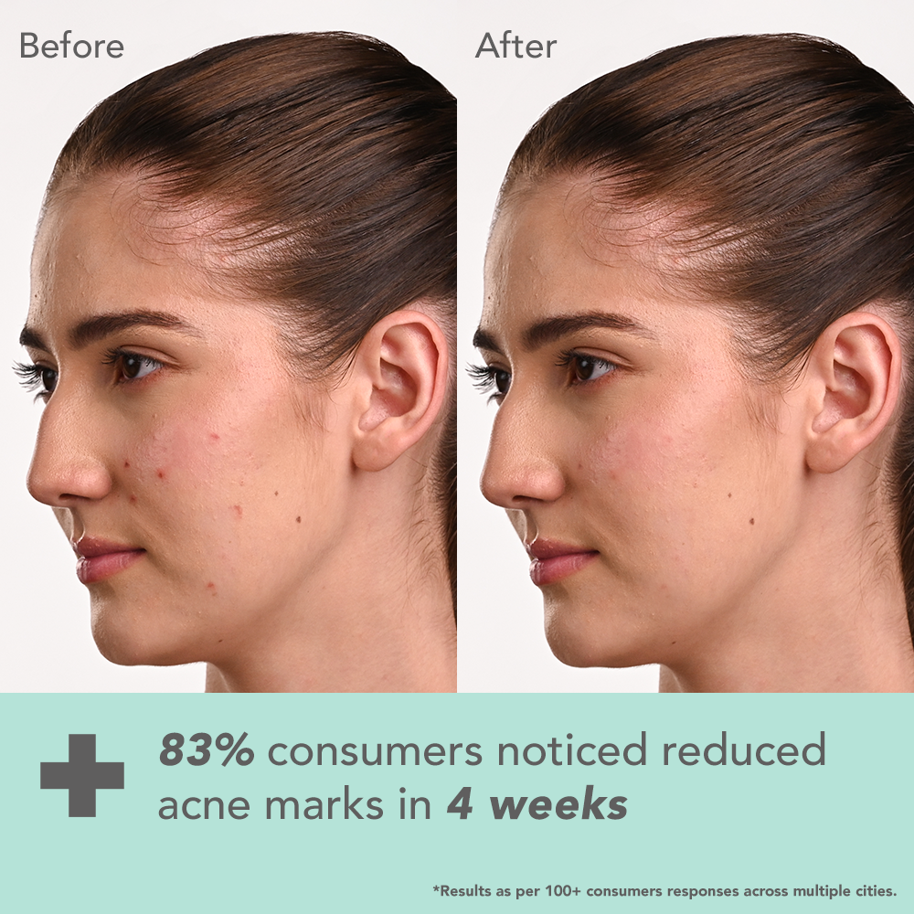 Dermabotanics Kojic acid + Multiberry Hi-dose serum