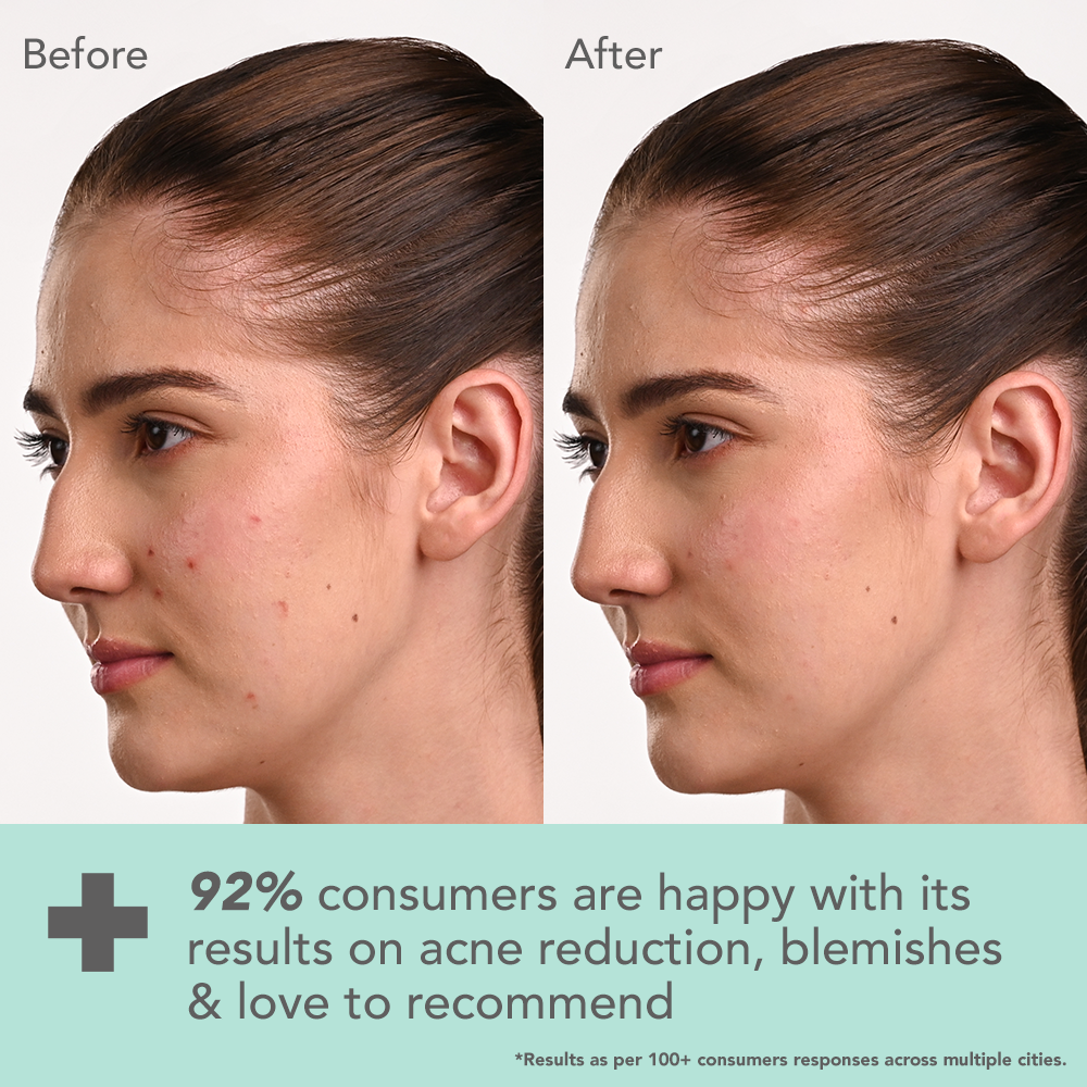 Dermabotanics Kojic Acid + Multi Berry Blemish Free Facewash