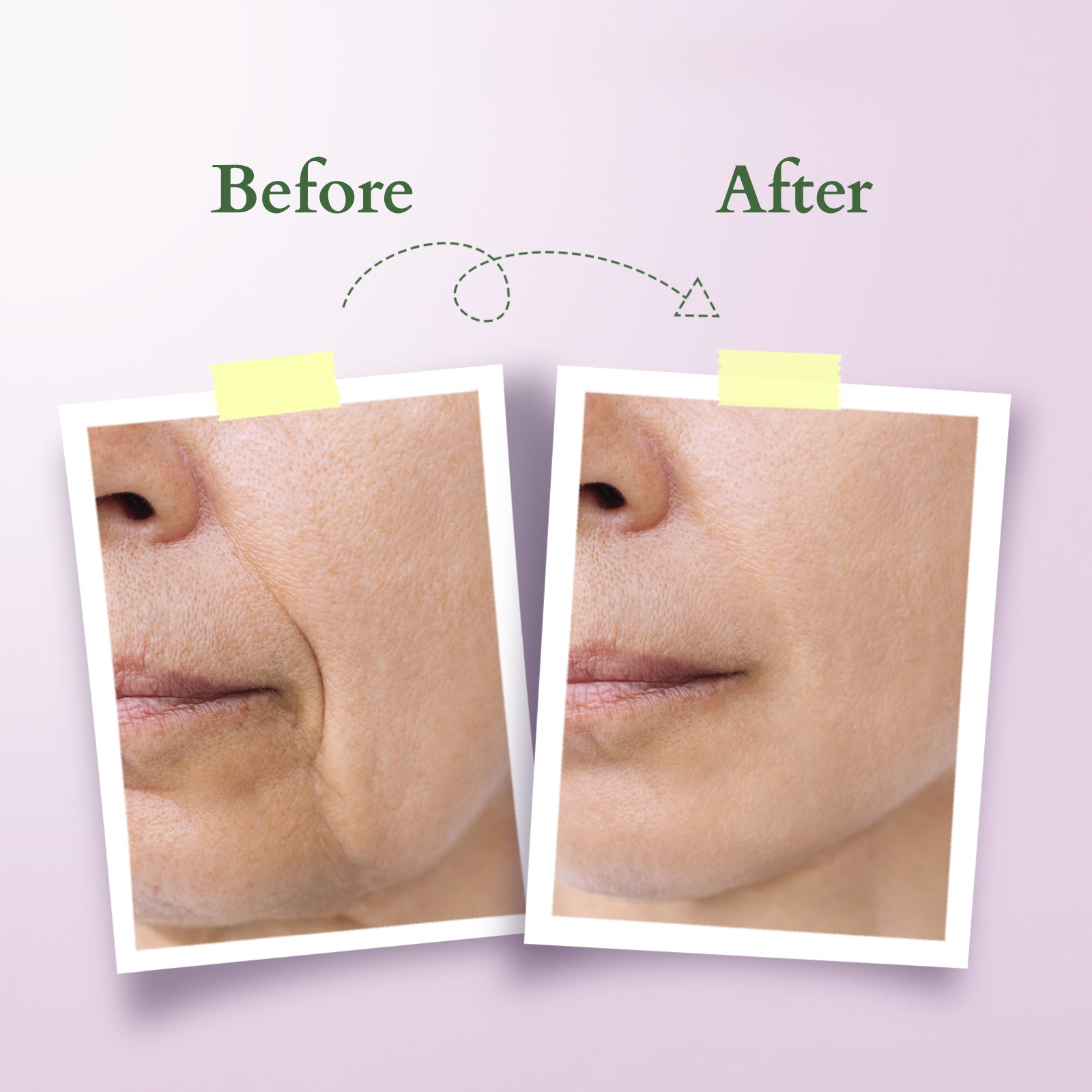 Lotus Bakuchiol Plant Retinol Night Recovery Crème