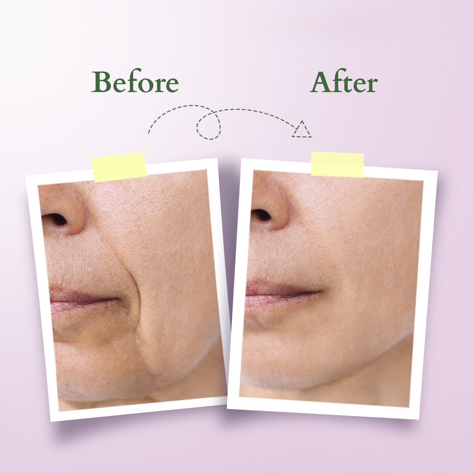 Lotus Organics+ Bakuchiol Plant Retinol Super Serum