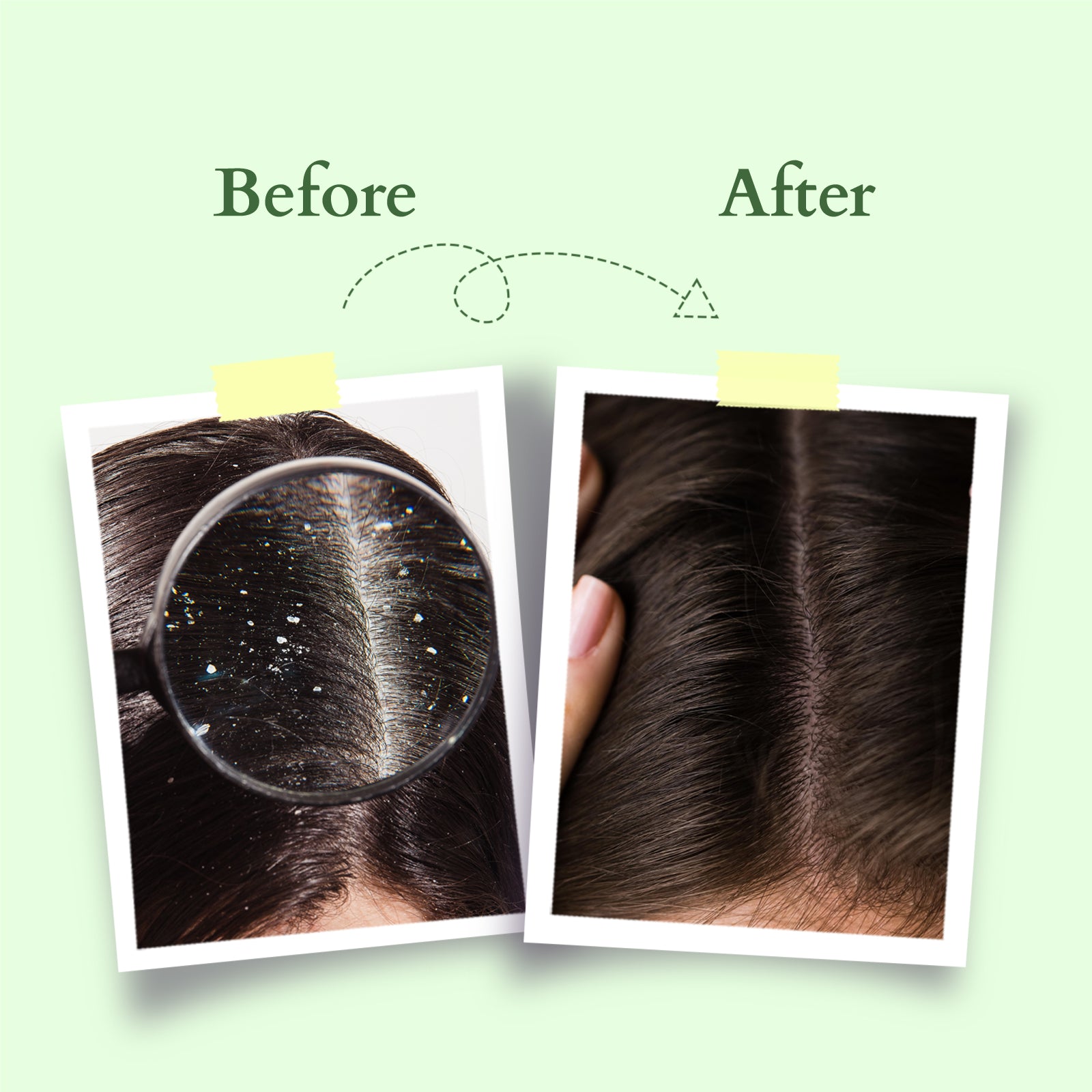 Lotus Chemical-Free Anti-Dandruff Shampoo