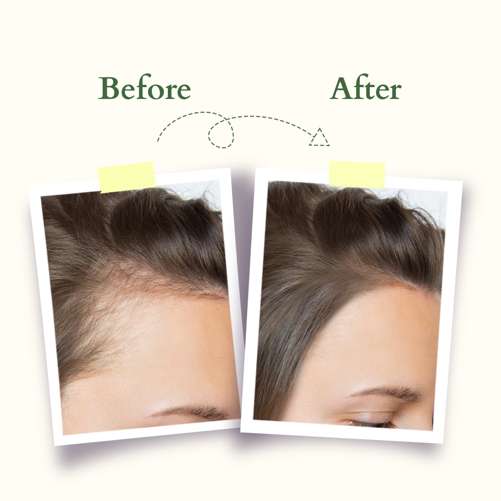 Intensive Scalp Care Shampoo