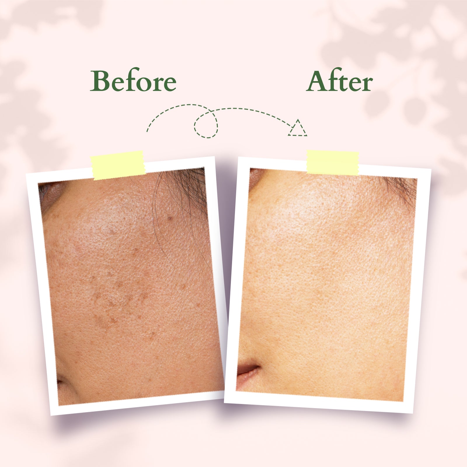 Lotus Precious Brightening Serum+ Creme