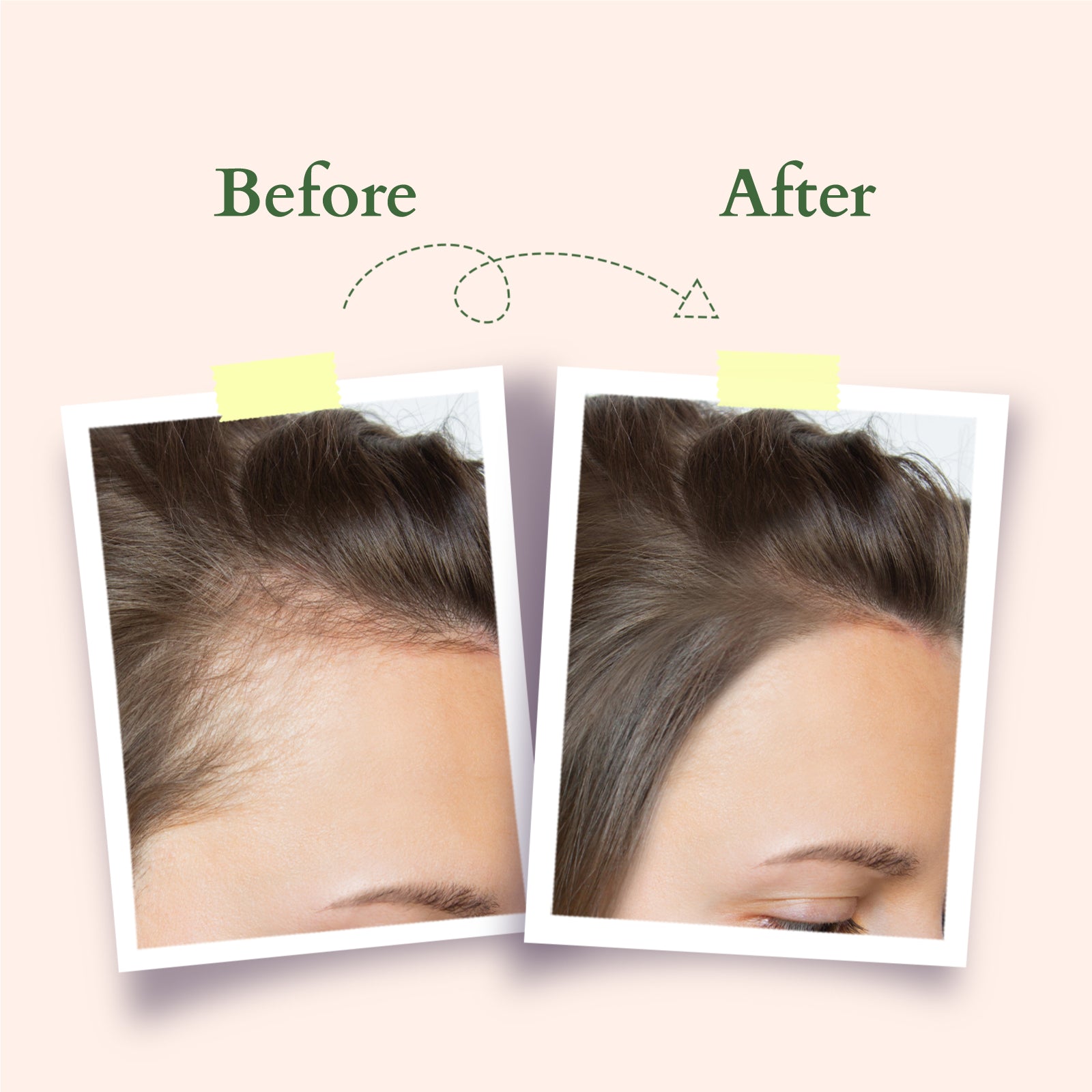 Hair Fall Control Multi Herbs Oil