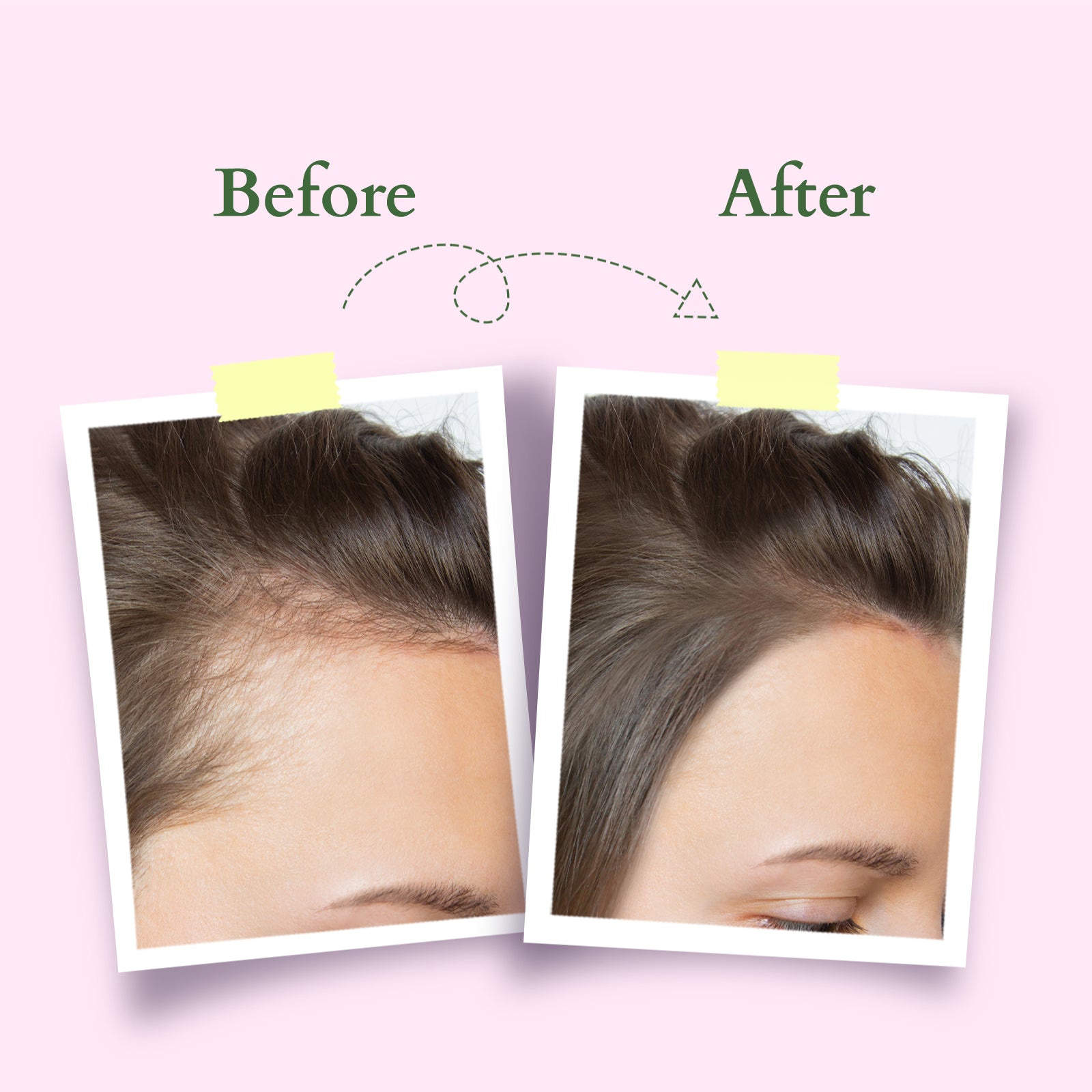 Hair Growth Active-Concentrate Serum
