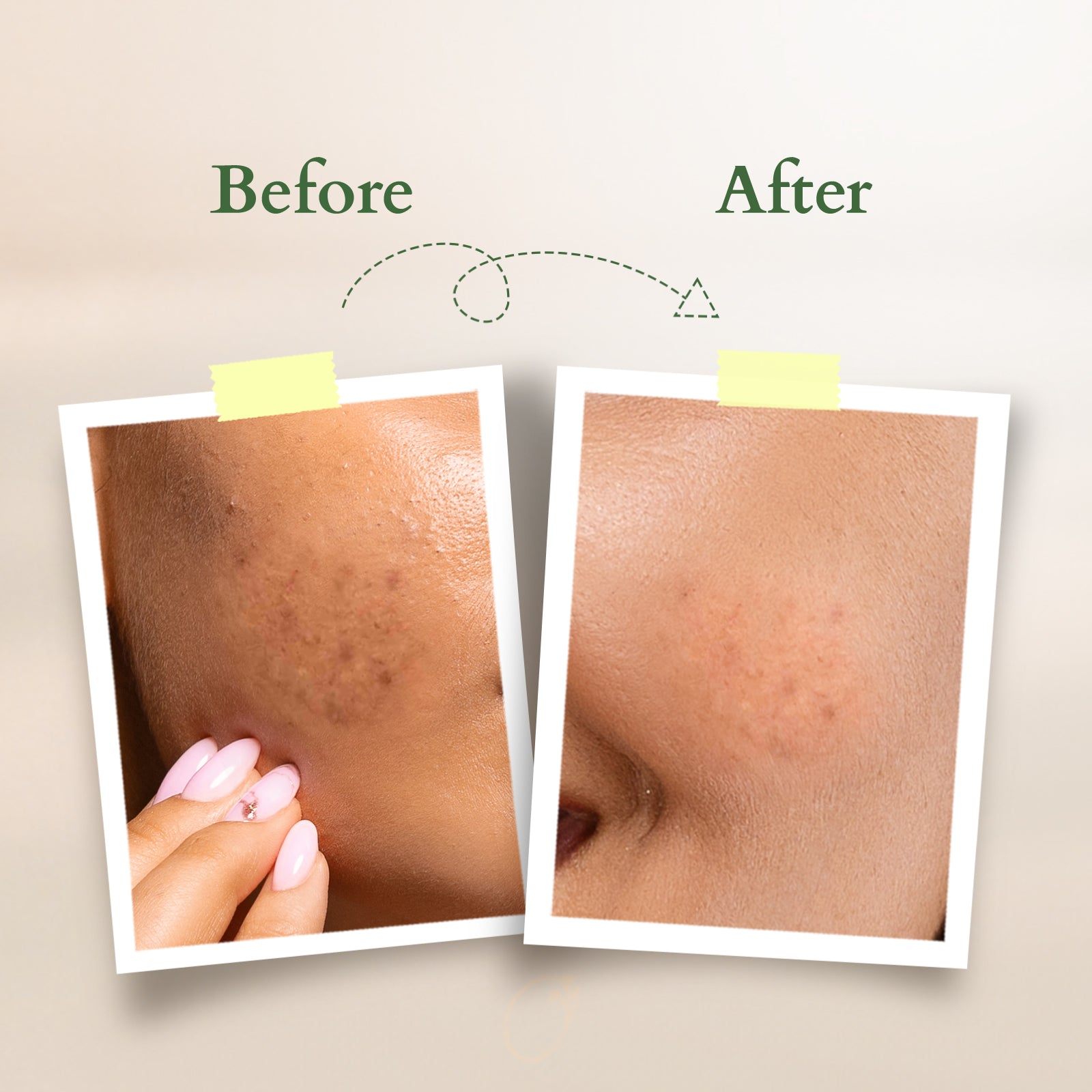 Lotus Vit - C Radiance Booster Serum